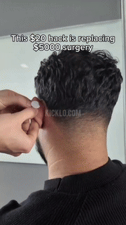 Cosmetic Ear Corrector - 6 Pcs