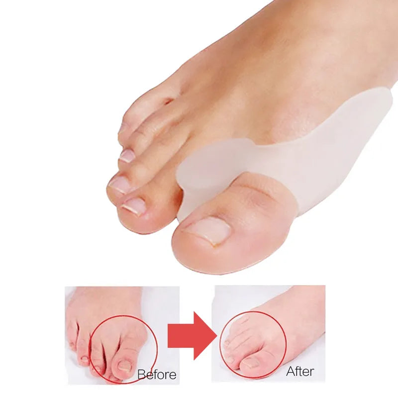 Silicone Toes Valgus Corrector