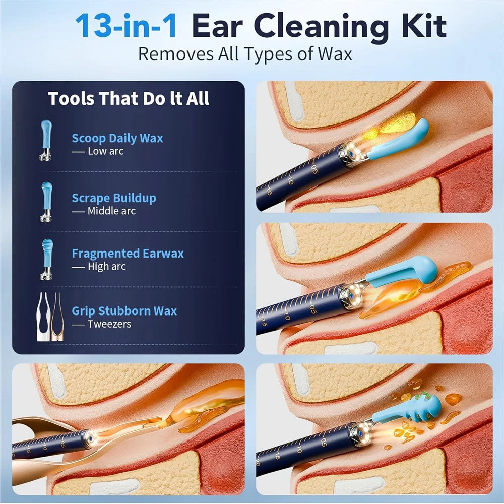 Visual Ear Wax Remover