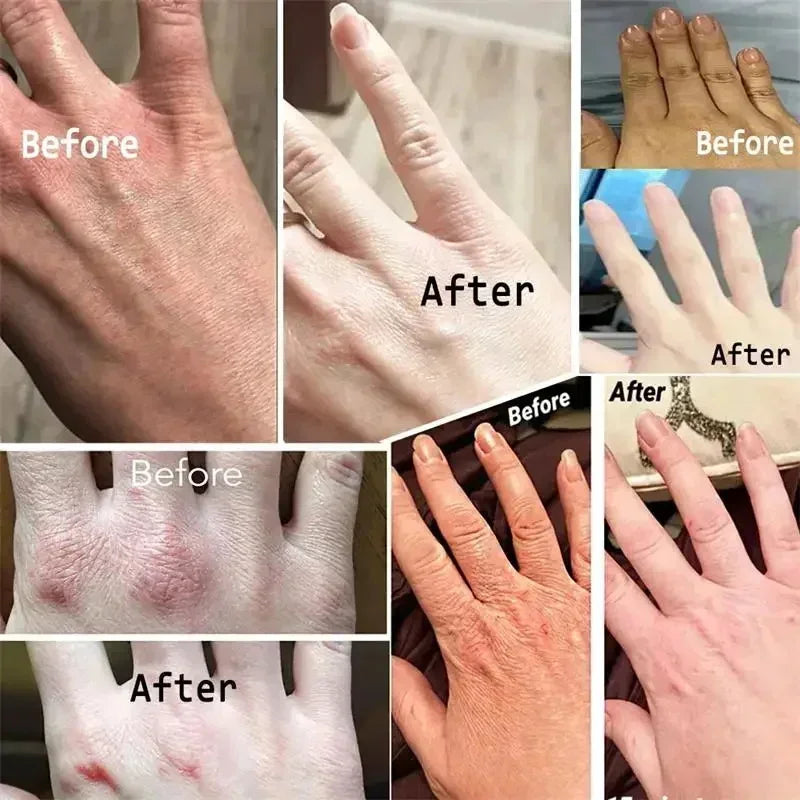 Anti-wrinkle Hand Cream