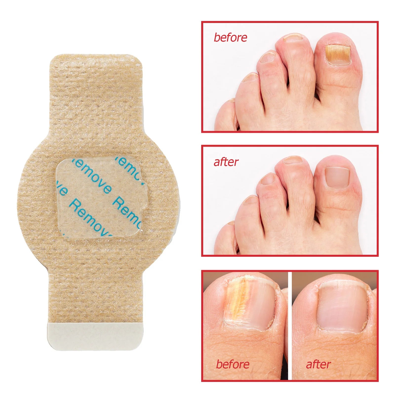 Nail Repair Patches