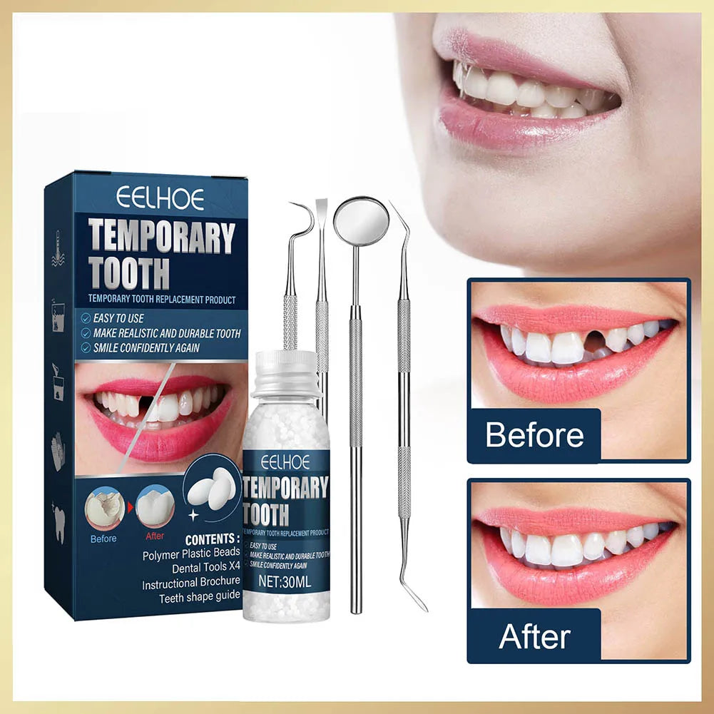 Temporary Tooth Repair Kit