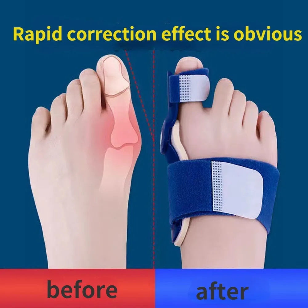Flexible Orthopaedic Bunion Corrector