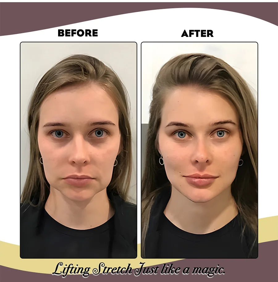 Elastic Face Lifting Band