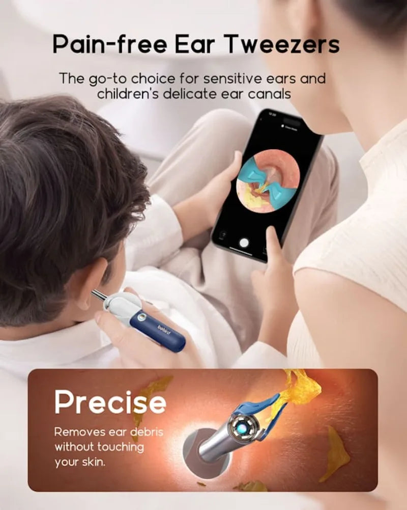 Visual Ear Wax Remover