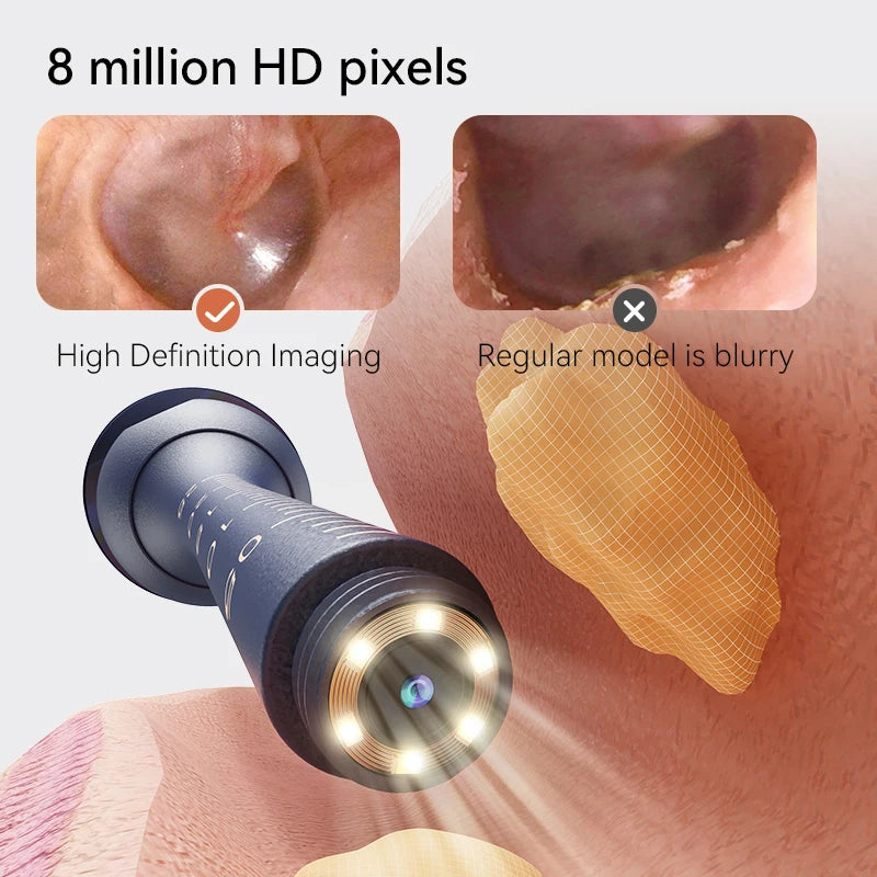 Visual Ear Wax Remover