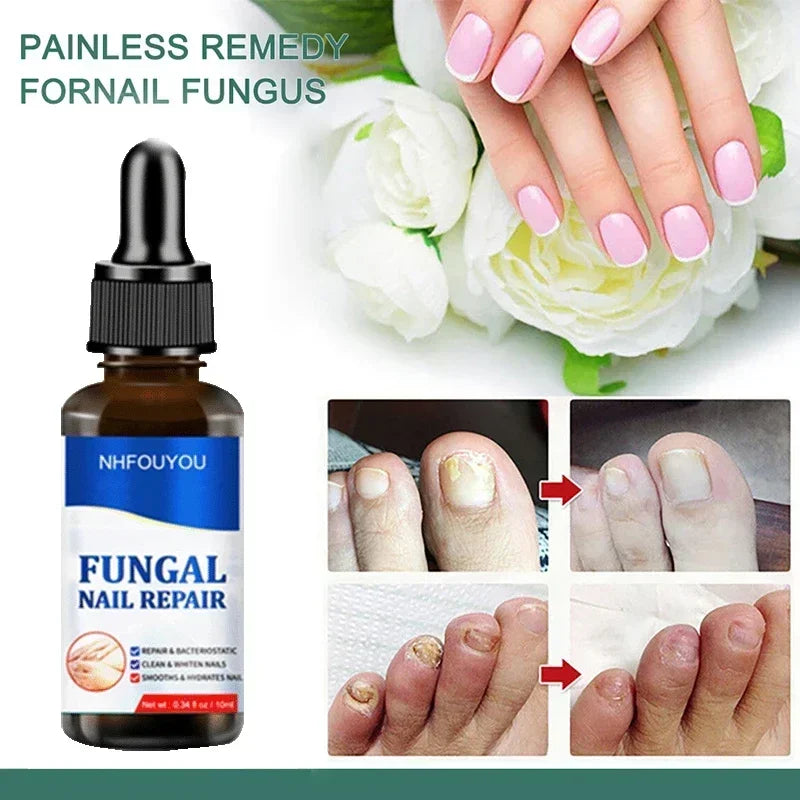 Nail Fungus Defender Serum