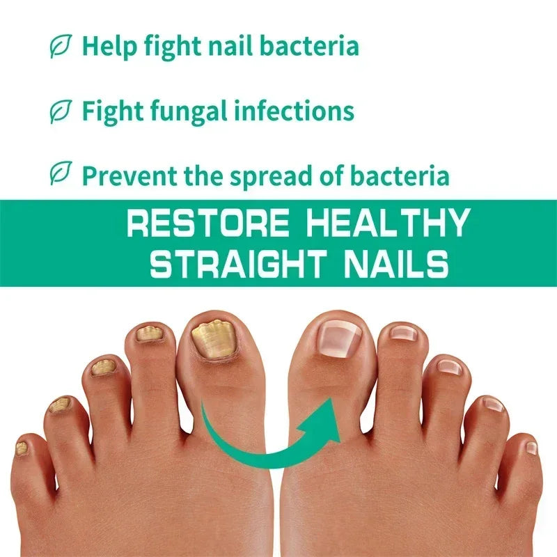 Nail Fungus Defender Serum