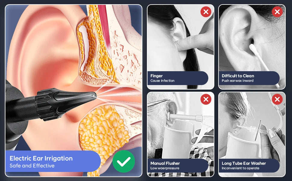 Electric Ear Wax Removal Kit
