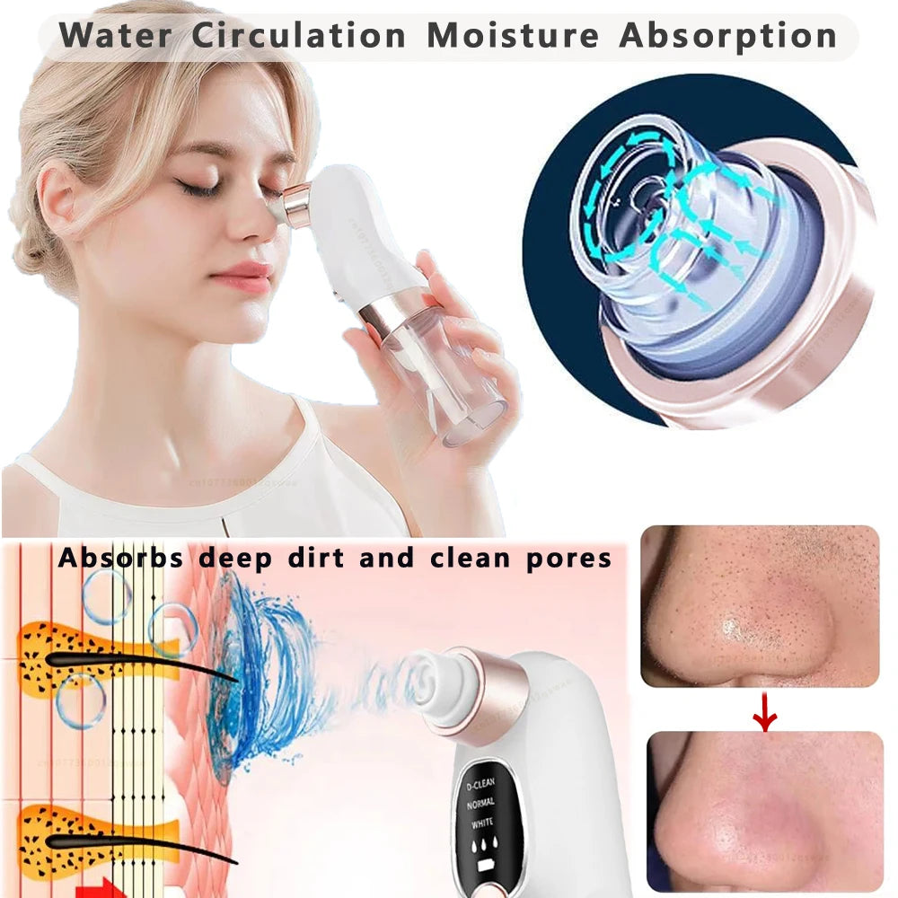 Acne Black Head Deep Clean Removal