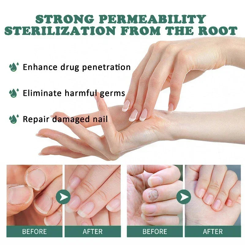 Nail Fungus Defender Serum