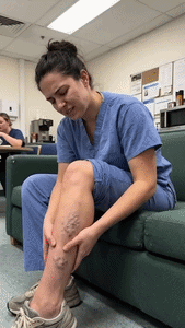 Varicose Veins Relief Cream