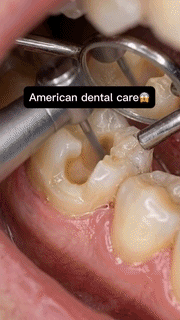Traditional Teeth Whitening Toothbrush