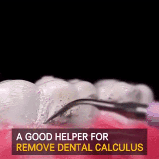 Electric Dental Calculus Remover