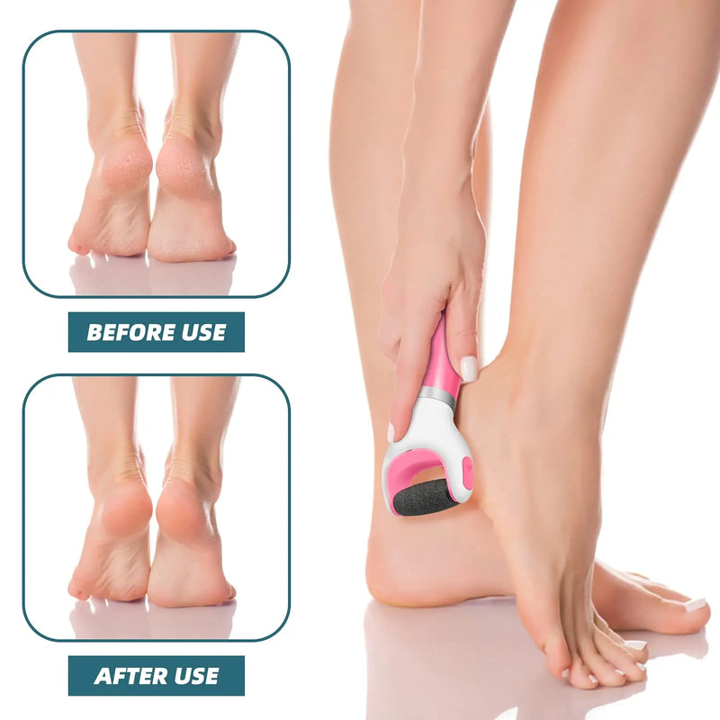 USB Foot Callus Remover Pedicure Tool