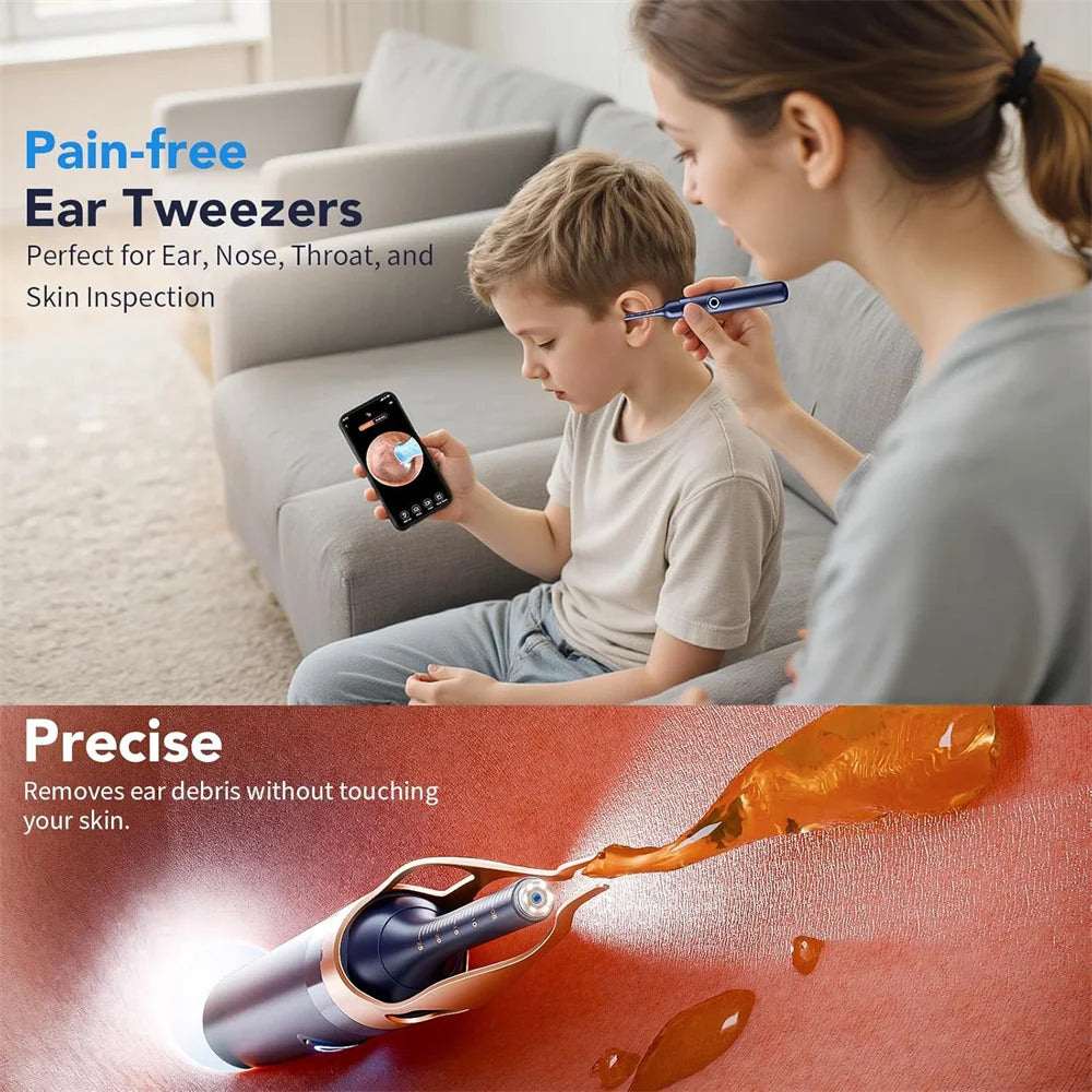 Visual Ear Wax Remover