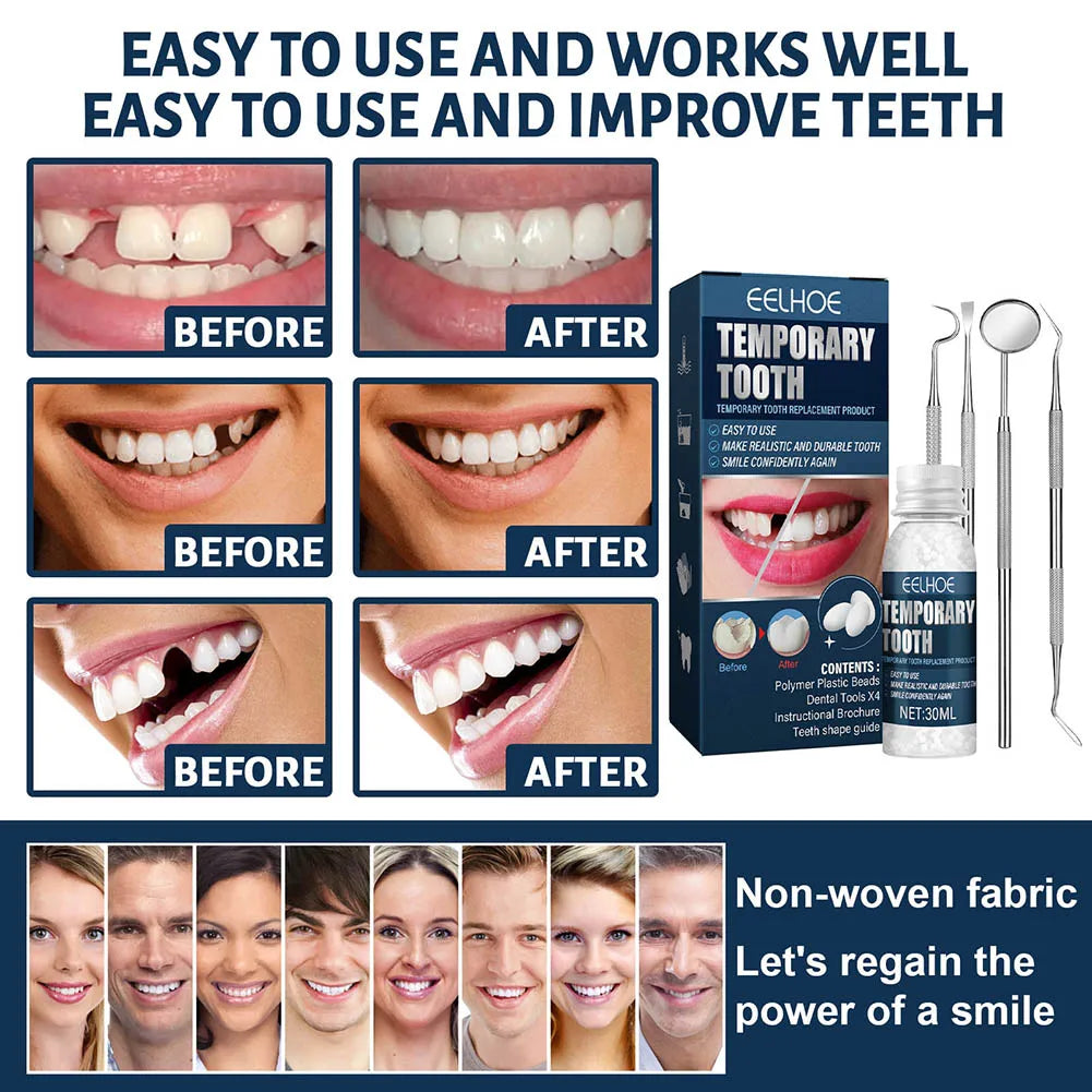 Temporary Tooth Repair Kit