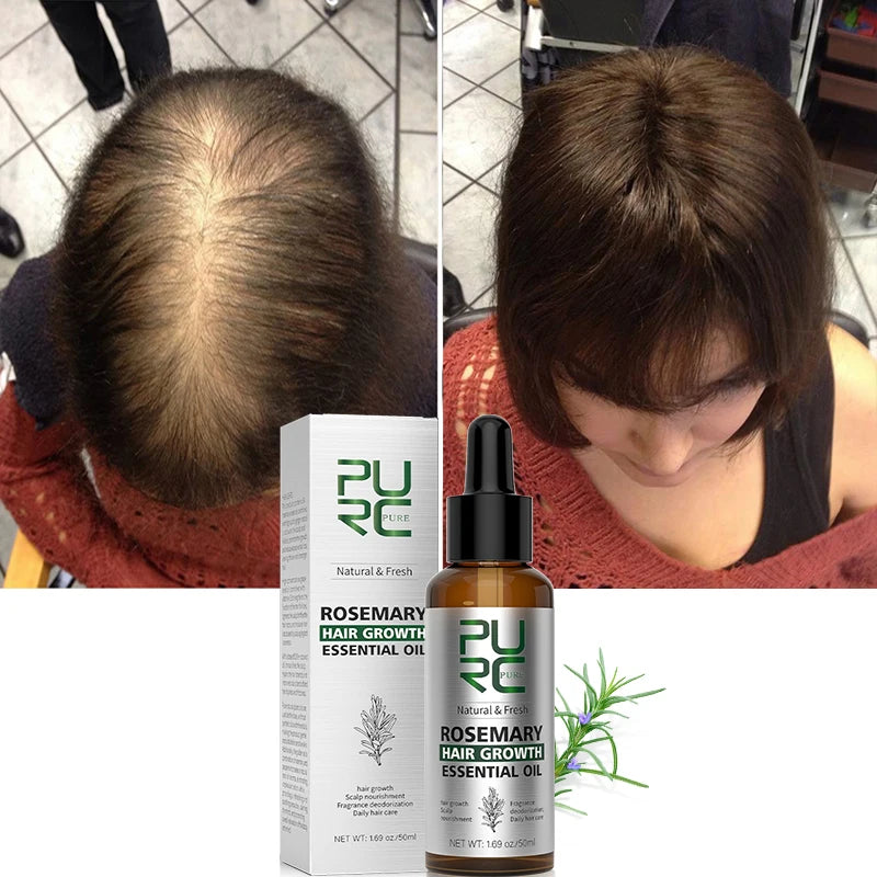 Rosemary Hair Growth Essential Oil