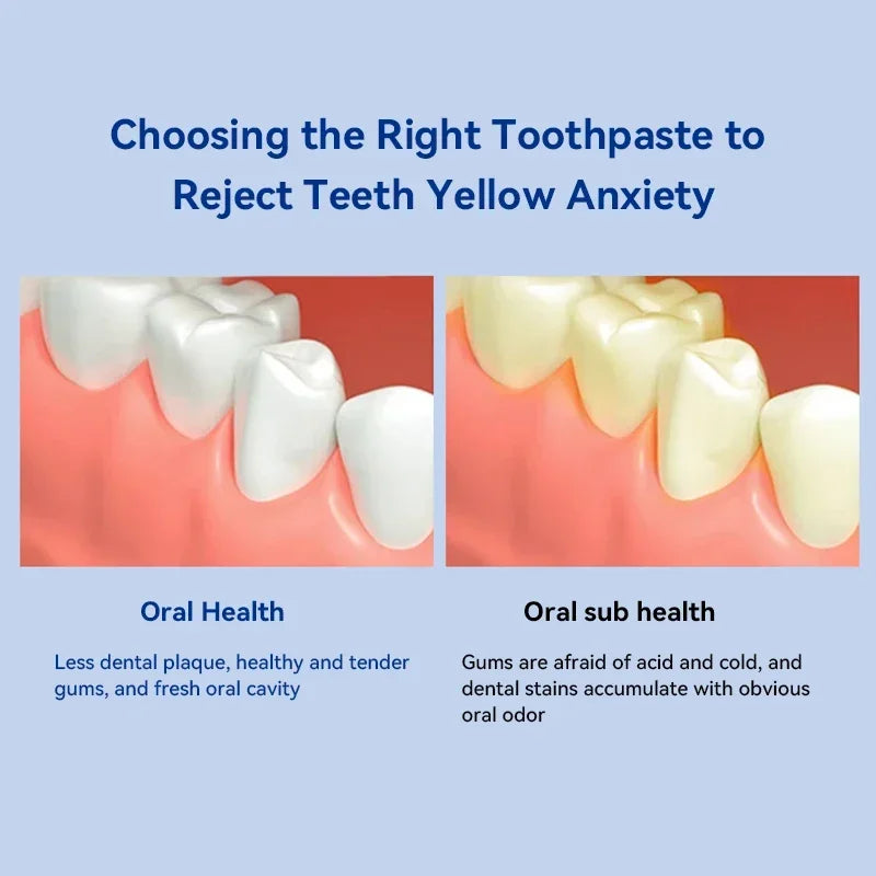 Dental Calculus Removing Toothpaste