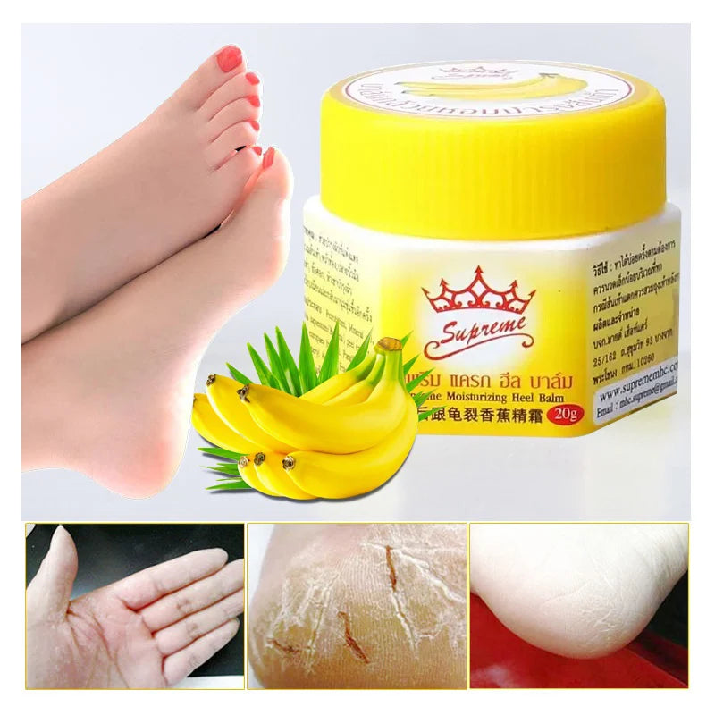 Dead Skin Remover Crack Cream