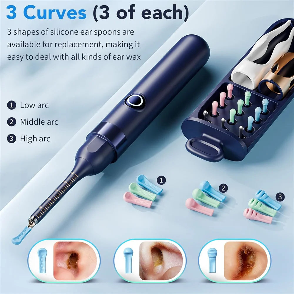 Visual Ear Wax Remover