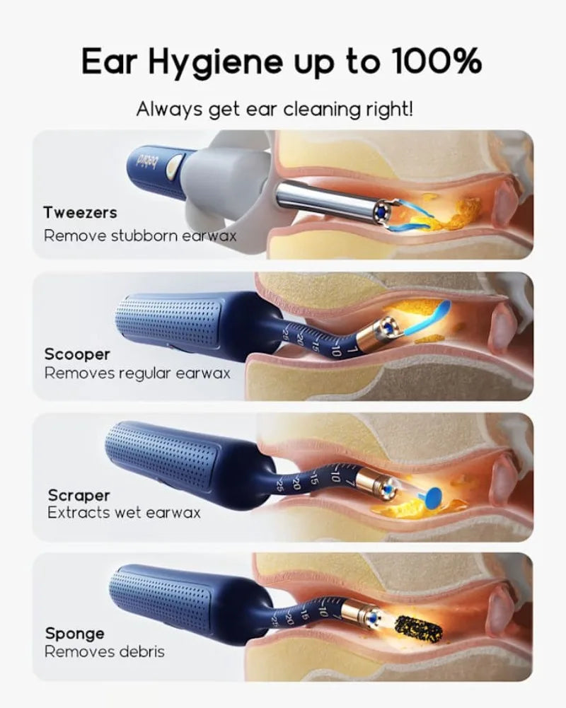 Visual Ear Wax Remover