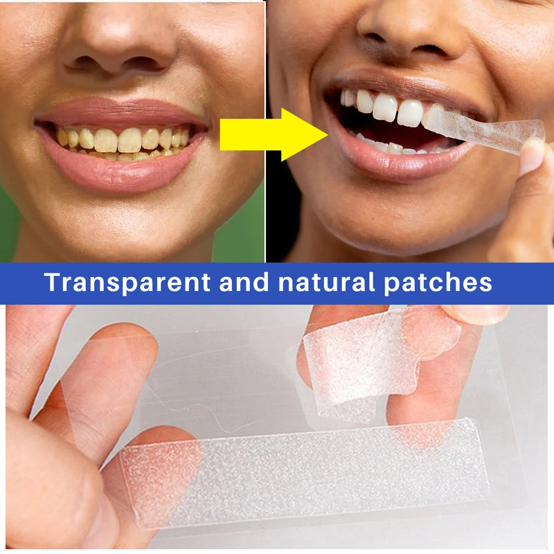 Teeth Whitening Strips