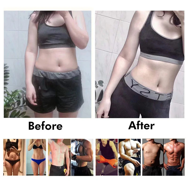EMS Muscle Toning Device