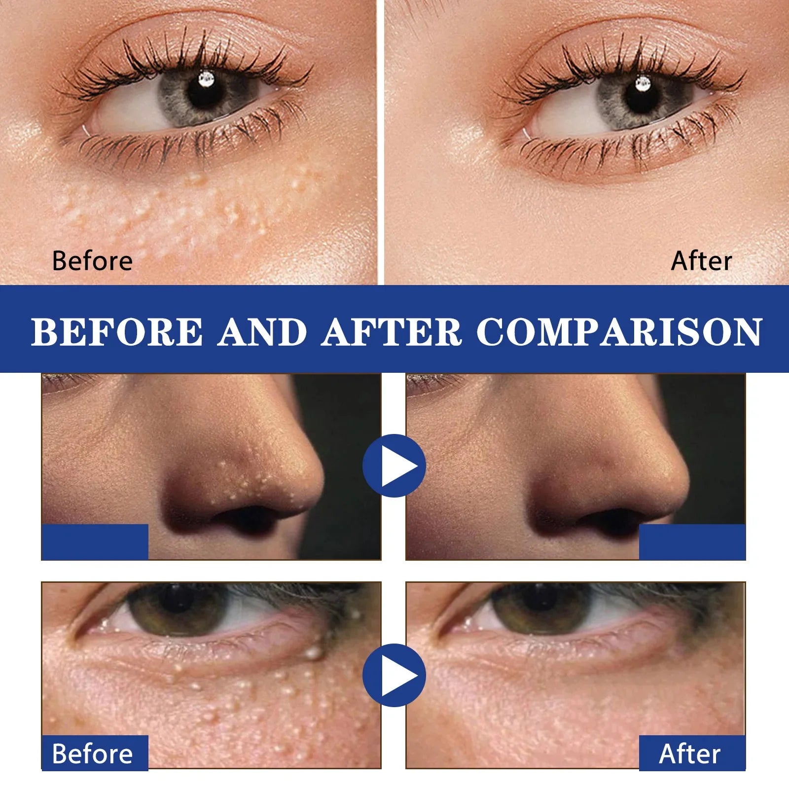 Under-Eye Granule Removal Serum