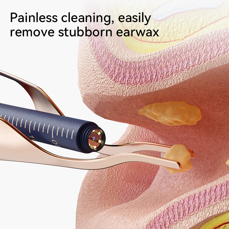 Visual Ear Wax Remover