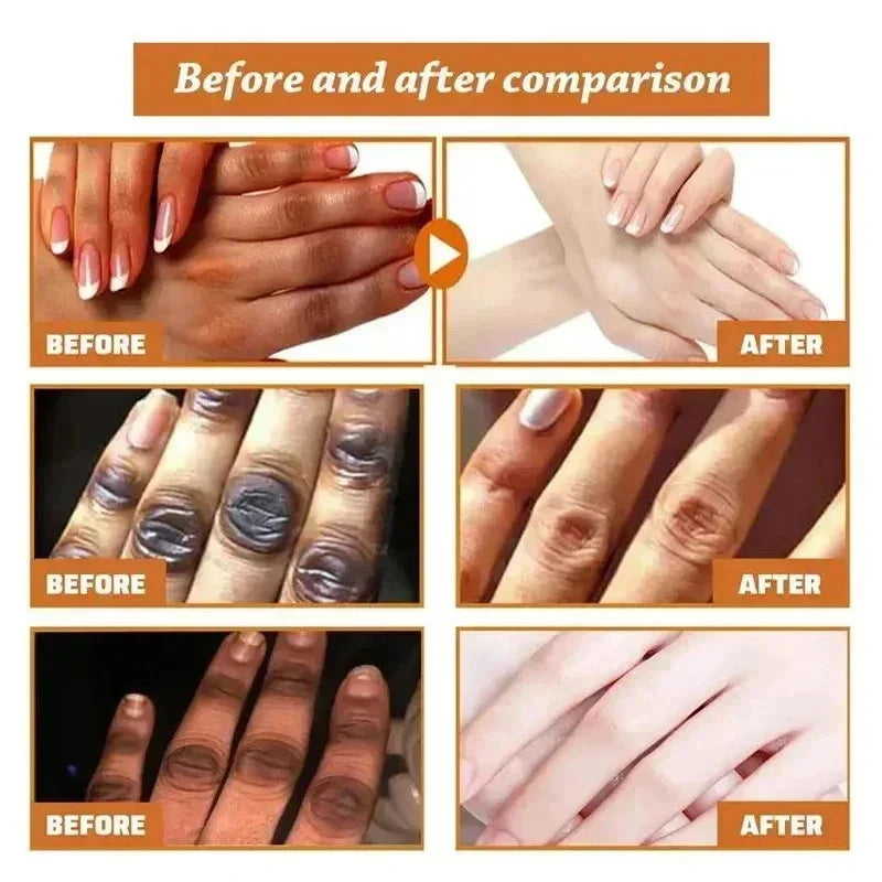 Dark Spot Removal Serum