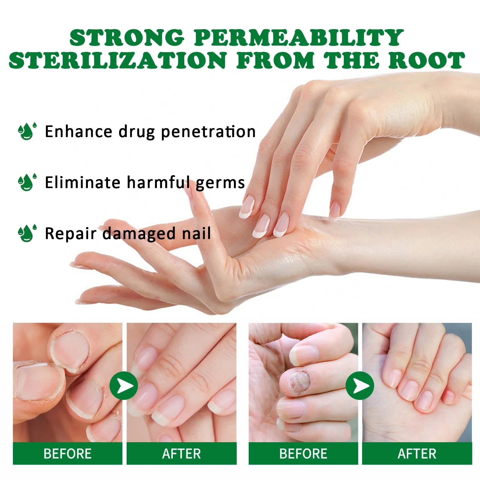 Nail Fungus Defender Serum