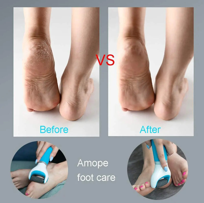 USB Foot Callus Remover Pedicure Tool