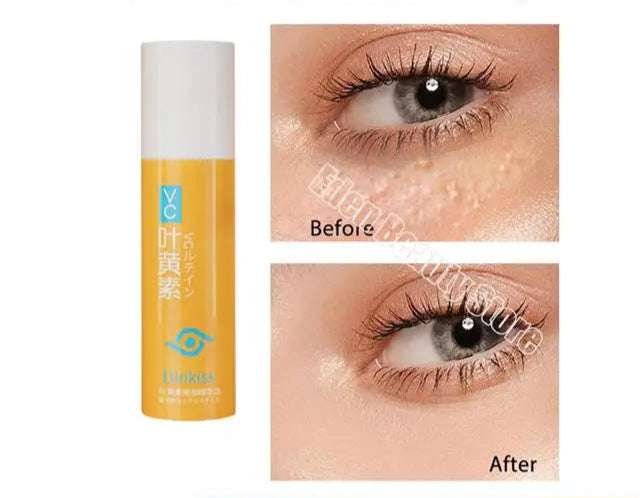 Under-Eye Granule Removal Serum