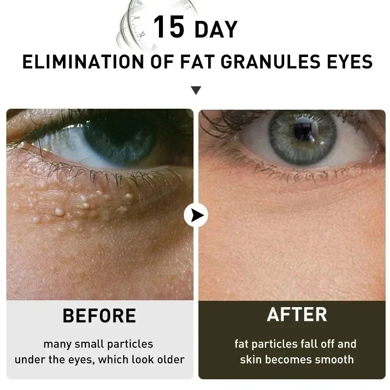 Under-Eye Granule Removal Serum