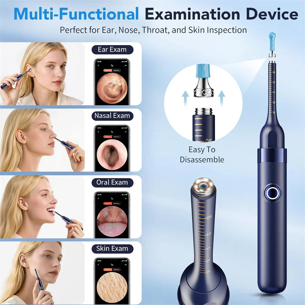 Visual Ear Wax Remover