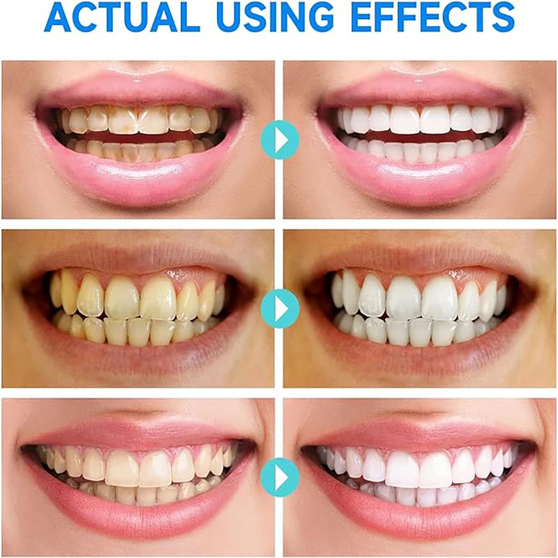 Herbal Stain Removal Whitening Toothpaste