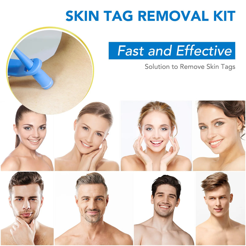 Skin Tag Removal Kit