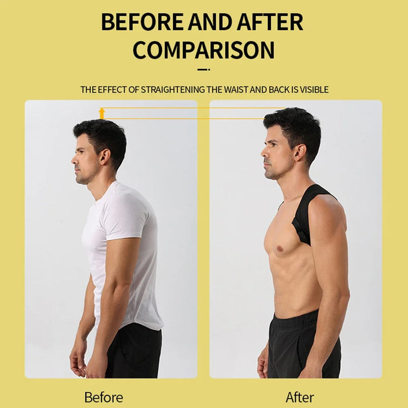 Adjustable Neck And Shoulder Posture Corrector