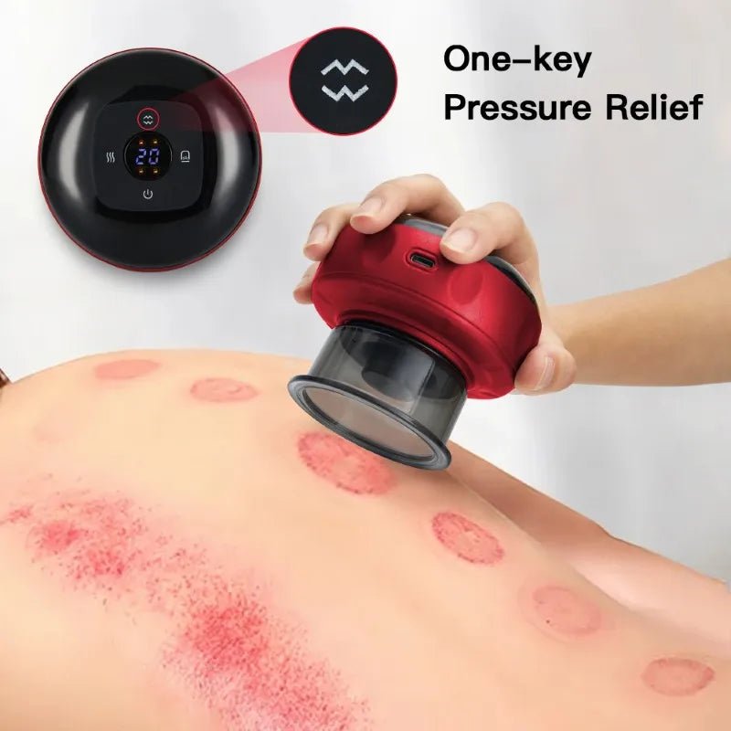 Electric Vacuum Cupping Therapy