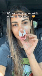 Painless Nose Bridge Corrector