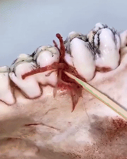 Stainless Steel Reusable Toothpick Set