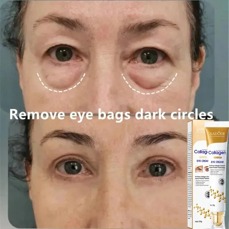 Instant Eye Bag Removal